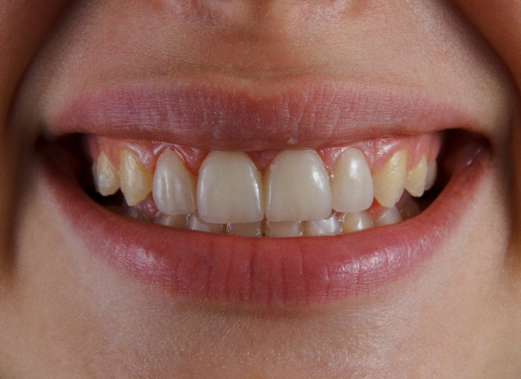 Sonrisa Saludable